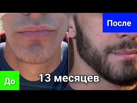 Видео: Как запустить рост бороды с нуля. 13 месяцев мажу средство для роста бороды и волос. Выпуск 87