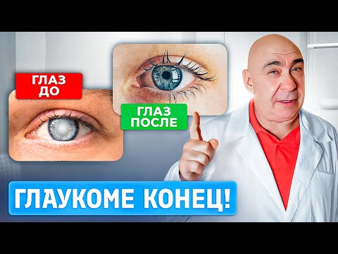 Видео: Как НАВСЕГДА ИЗБАВИТЬСЯ от глаукомы? 5 СЕКРЕТНЫХ упражнений…