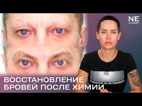 Видео: Восстановление бровей после химиотерапии. #татуаж мужчинам