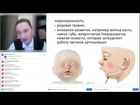 Видео: Задержка речевого развития.   Практические инструменты развития речи детей для воспитателей