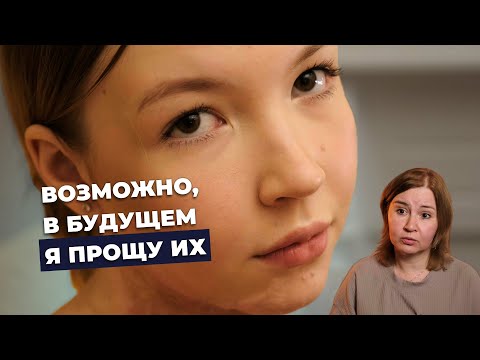 Видео: ПОСЛЕОЖОГОВЫЕ РУБЦЫ | История Киры Красновой