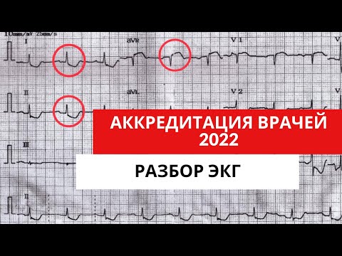 Видео: Разбор ЭКГ из АККРЕДИТАЦИИ 2022 года (для кардиологов, терапевтов, функциональных диагностов)Часть 1