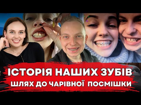 Видео: Історія лікування наших зубів. Яка вартість і як Галя дійшла до чарівної посмішки?