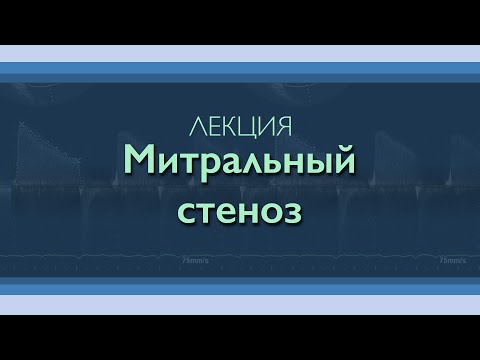 Видео: Митральный стеноз