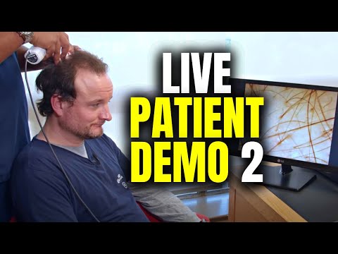 Видео: Демонстрация на живом пациенте