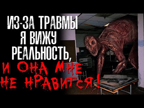 Видео: ИЗ-ЗА ТРАВМЫ Я ВИЖУ РЕАЛЬНОСТЬ - И ОНА МНЕ НЕ НРАВИТСЯ! Страшные/Жуткие истории на ночь