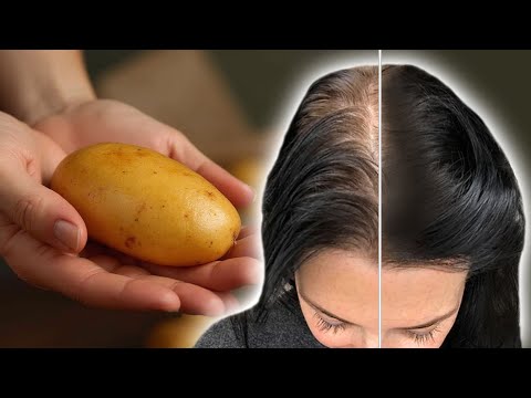 Видео: Волосы растут как сумасшедшие и не выпадают! самый эффективный рецепт!