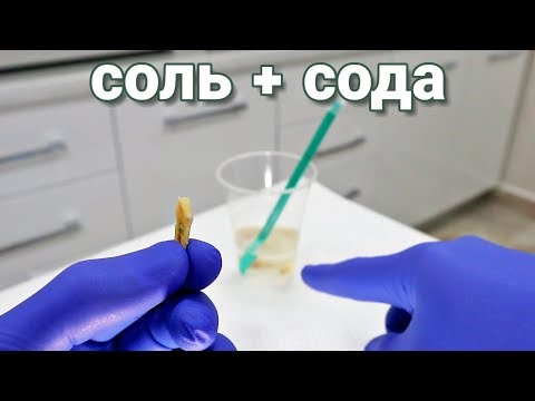 Видео: Идеальные Зубы. Соль+Сода