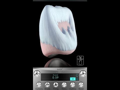Видео: Нанесение керамической массы, программа . Для начинающих. Зубной техник. GC Initial.Металлокерамика