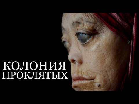 Видео: КОЛОНИЯ ПРОКЛЯТЫХ История Путешествия Кэт Марсден в Якутию MISS KATE MARSDEN