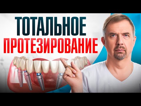 Видео: ТОТАЛЬНОЕ ПРОТЕЗИРОВАНИЕ зубов. Как вернуть улыбку?