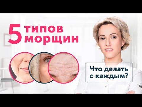 Видео: ЕСЛИ появились МОРЩИНЫ: 5 видов морщин и что с ними делать