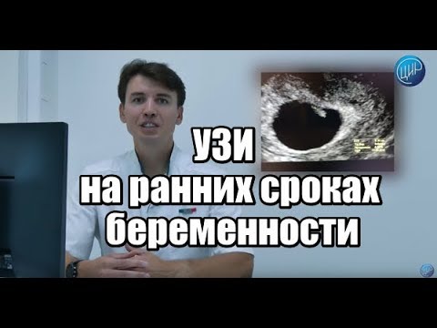 Видео: УЗИ при беременности до 11 недель беременности