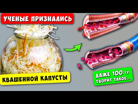 Видео: Вот она - Правда! Реакция КРОВИ на КВАШЕНУЮ КАПУСТА вас удивит!