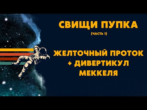 Видео: Пупочно-кишечный свищ | Дивертикул Меккеля | Аномалии желточного протока | Свищи пупка Часть 1