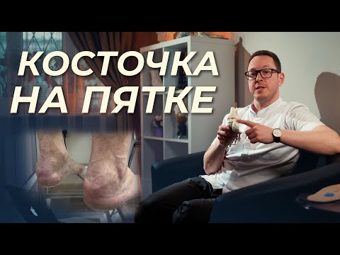 Видео: Деформация Хаглунда – как появляется и что делать?