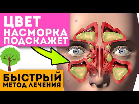 Видео: Если у вас зеленые сопли, значит, поможет только…
