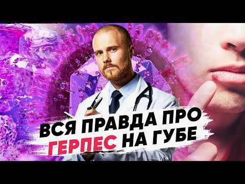 Видео: Опасен ли вирус герпеса? Герпес на губах лечение. Можно ли избавиться от вируса герпеса навсегда.