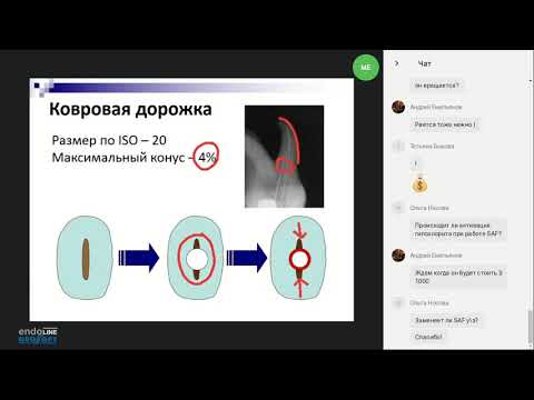 Видео: Endo.Education Вебинар Михаила Елендо "Мифология SAF: распространенные заблуждения"