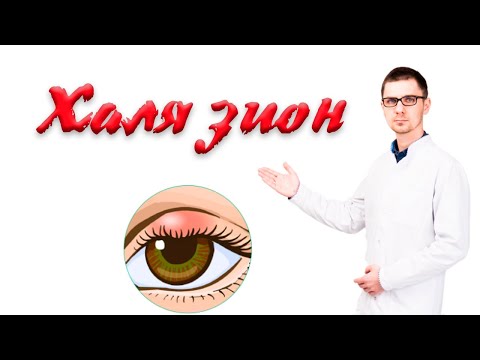 Видео: Халязион или шишка на веке