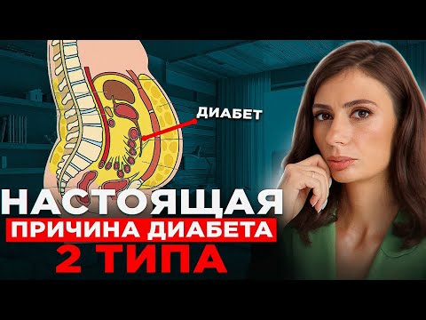 Видео: Настоящая причина сахарного диабета 2 типа | НЕ сахар и НЕ углеводы