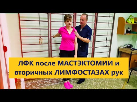 Видео: ЛФК после мастэктомии и вторичных лимфостазах рук.