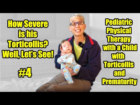 Видео: # 4 Насколько серьезна его кривошея?: Физиотерапия ребенка с кривошеей и недоношенностью