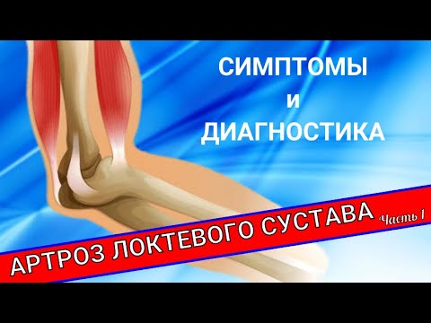 Видео: АРТРОЗ ЛОКТЕВОГО СУСТАВА (Часть 1)