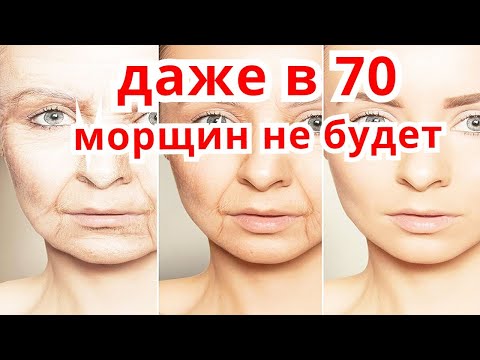Видео: ЛЕГЕНДАРНАЯ МАСКА от МОРЩИН ! Даже в 70 лет Омолодит Лицо Дрожжевая Маска