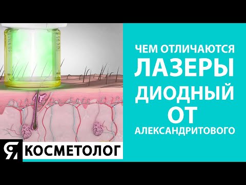 Видео: Чем отличаются лазеры – диодный от александритового? Лазерная эпиляция