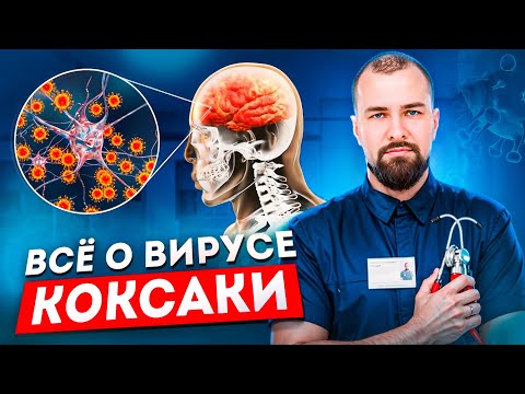Видео: Энтеровирусная инфекция (Коксаки)