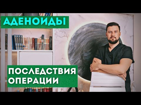 Видео: Аденоиды. Какие могут быть последствия если удалить аденоиды ребенку.