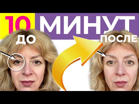 Видео: НАВИСШИЕ ВЕКИ ПОДТЯНУТСЯ на 1\2 см за 10 МИНУТ. Экспресс массаж - замена  БЛЕФАРОПЛАСТИКИ дома.