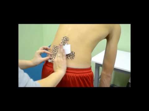 Видео: Как клеить кинезио тейп на поясницу
