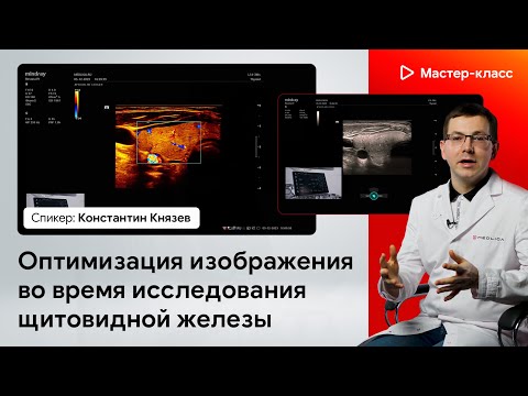 Видео: Оптимизация изображения во время исследования щитовидной железы