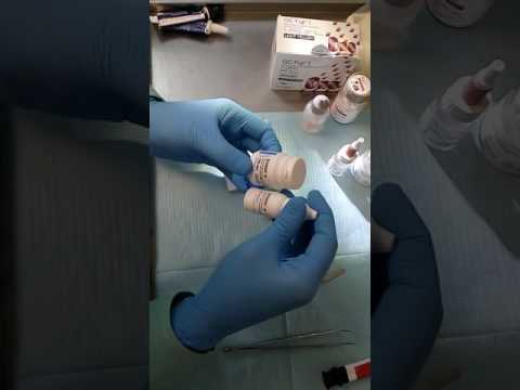 Видео: Цементировка коронки