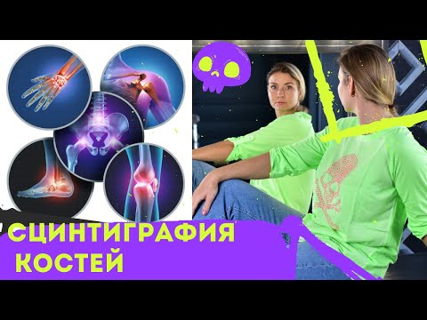 Видео: Сцинтиграфия костей изотопное исследование. Точность при раке, полиартрите и др болезнях костей.