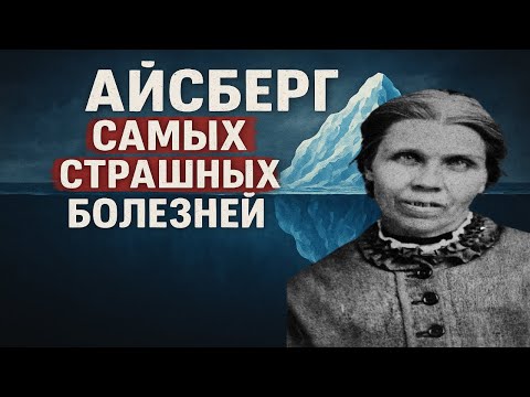 Видео: Самые СТРАШНЫЕ БОЛЕЗНИ | Айсберг