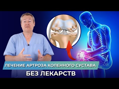 Видео: Артроз колена — простое объяснение и упражнения для всех!