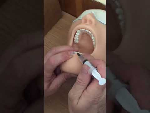 Видео: Анестезии в стоматологии , OSCE-1