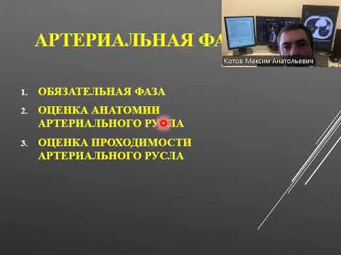 Видео: Избранные вопросы КТ-ангиографии.