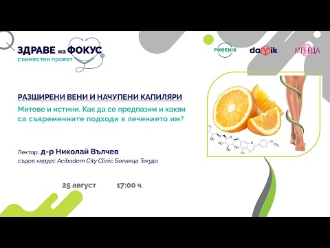 Видео: Разширени вени и начупени капиляри - проект "Здраве на фокус"