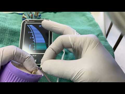 Видео: Советы по использованию апекслокатора для стоматологов общей практики