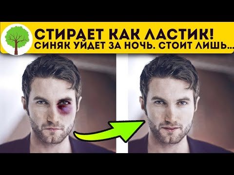 Видео: Наношу только это! Даже большие и черные синяки мигом проходят после…