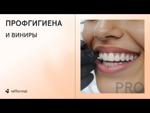 Видео: 👄 Профгигиена: можно ли делать, если установлены виниры?