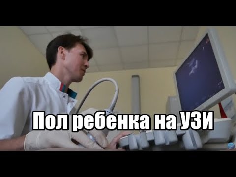 Видео: Пол ребенка на УЗИ в 13 недель. Рассказывает врач УЗД ЦИР А.А. Бикбулатов