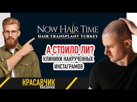 Видео: Now Hair Time Clinic. Отзыв о пересадке волос. Как определить накрученные Инстаграмы?  \ Красавчик