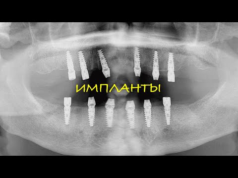 Видео: Почему те, кто ЗНАЕТ делают Съёмные?!