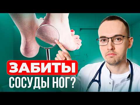 Видео: 5 ПРИЗНАКОВ ЗАБИТЫХ СОСУДОВ НОГ. Как проверить дома без врача?