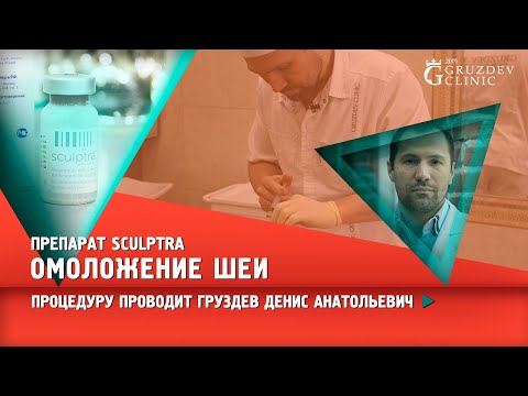 Видео: Омоложение шеи с использование препарата Sculptra